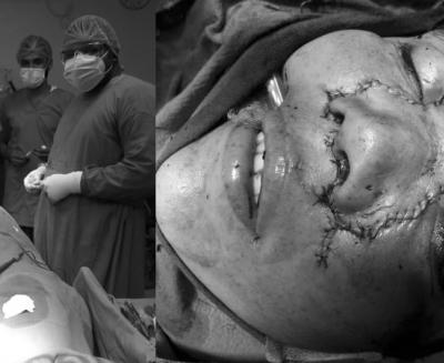 operation