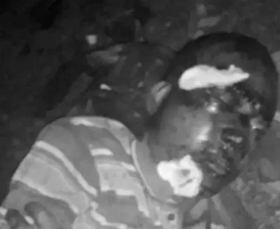 बैतडीमा मलामी गएका एक व्यक्ति घाइते अवस्थामा भेटिए